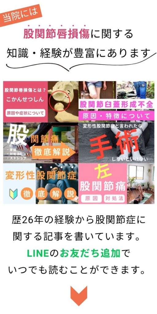 股関節唇損傷 痛み 改善
