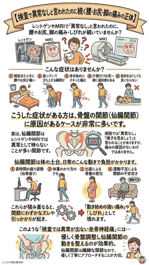 仙腸関節炎　坐骨神経痛　検査で異常なし